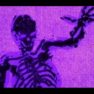 Meet your Posher, Andre